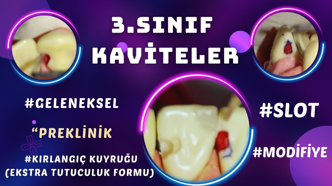 3.Sınıf Kaviteler (Class 3 )