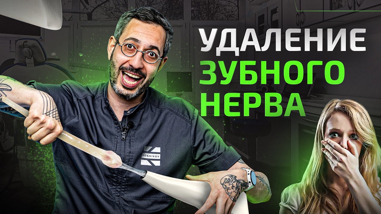 Нерв зуба — удаление. Как выглядит нерв? Причины и последствия удаления
