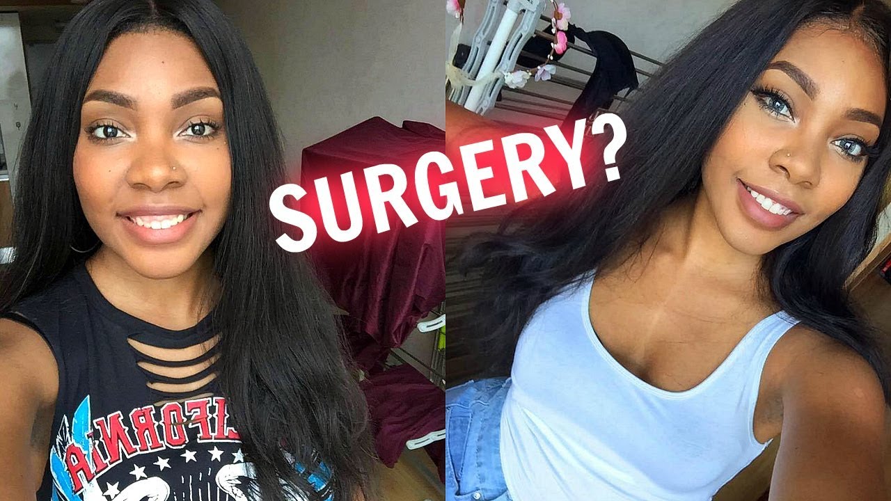 MY SURGERY IN SEOUL, KOREA | VLOG