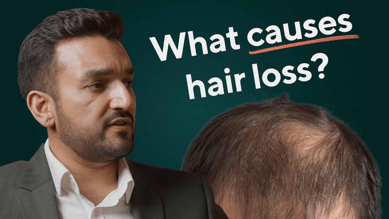 How to stop hair loss, treatments that work and what to do pre-hair transplant