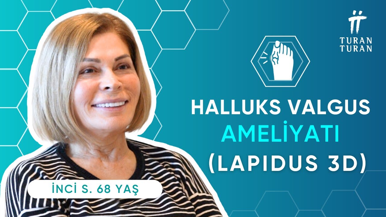 Başparmak Çıkıntısı Ameliyatı Olanların Yorumları: İnci Hanım (Lapidus 3D Halluks Valgus Ameliyatı)