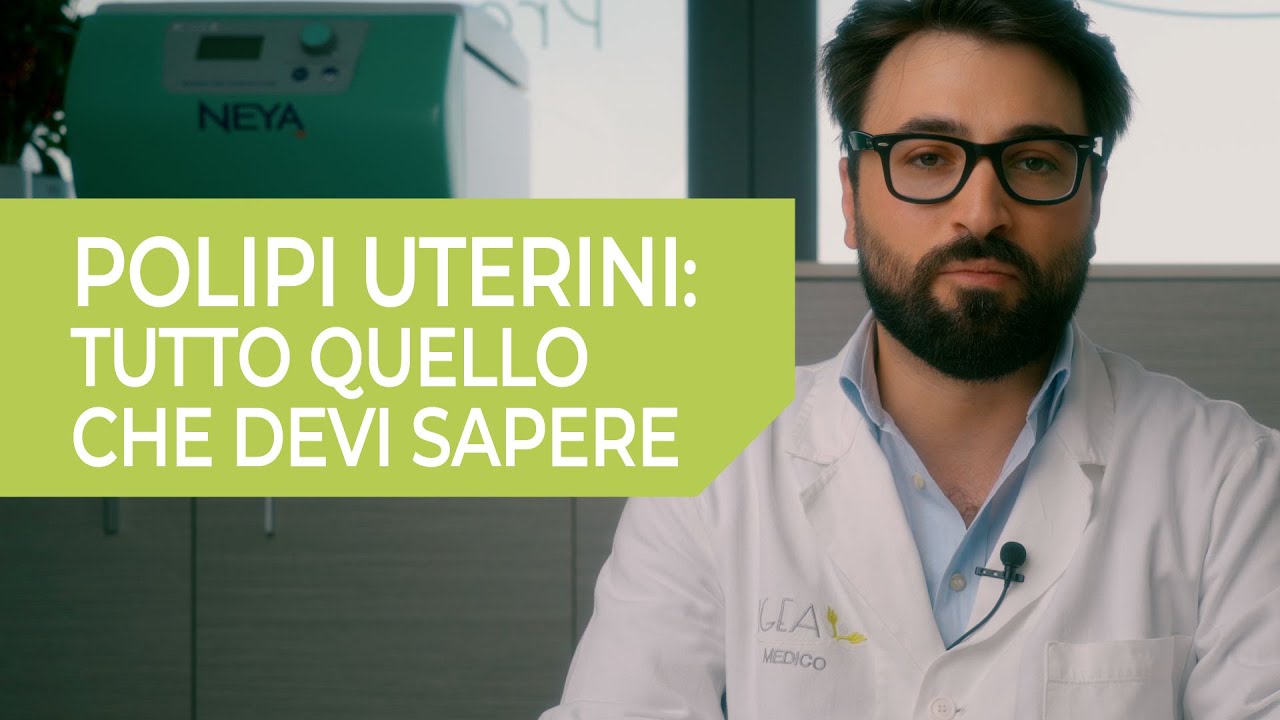 I POLIPI UTERINI: QUELLO CHE DEVI SAPERE - a cura del Dott. FERDINANDO MURGIA, ginecologo