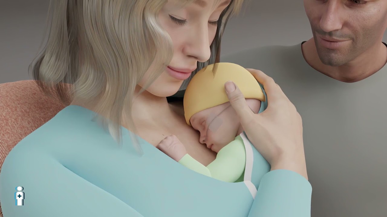 CAN EAT — Essen und Gedeihen mit Ösophagusatresie : Ein Film von ERNICA für Eltern und Familien
