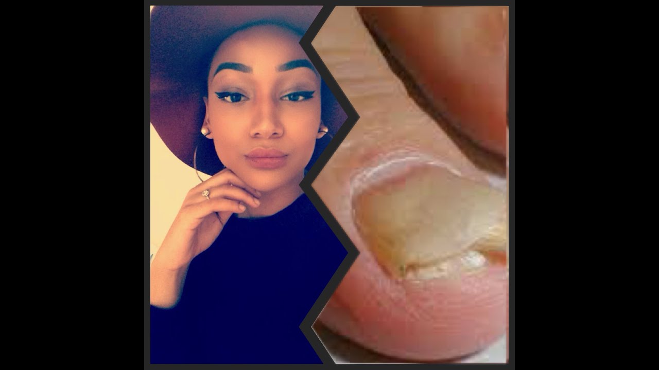 STORYTIME!!! J'ai faillit perdre mes ongles à Château d'eau.