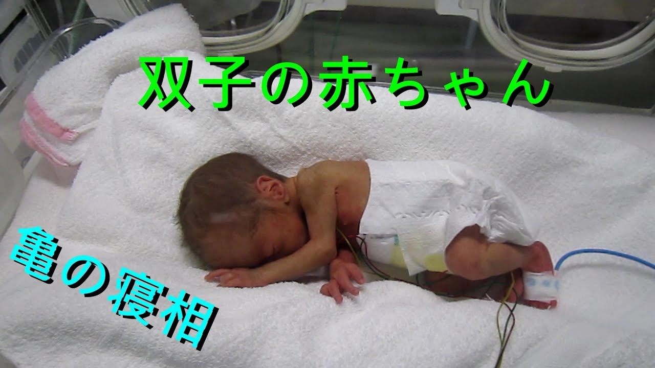 双子の赤ちゃん 未熟児の成長