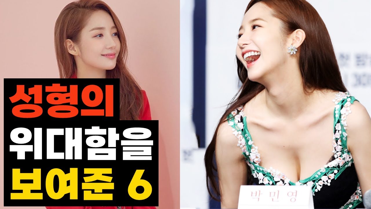 성형의 위대함을 보여준 여배우 TOP6