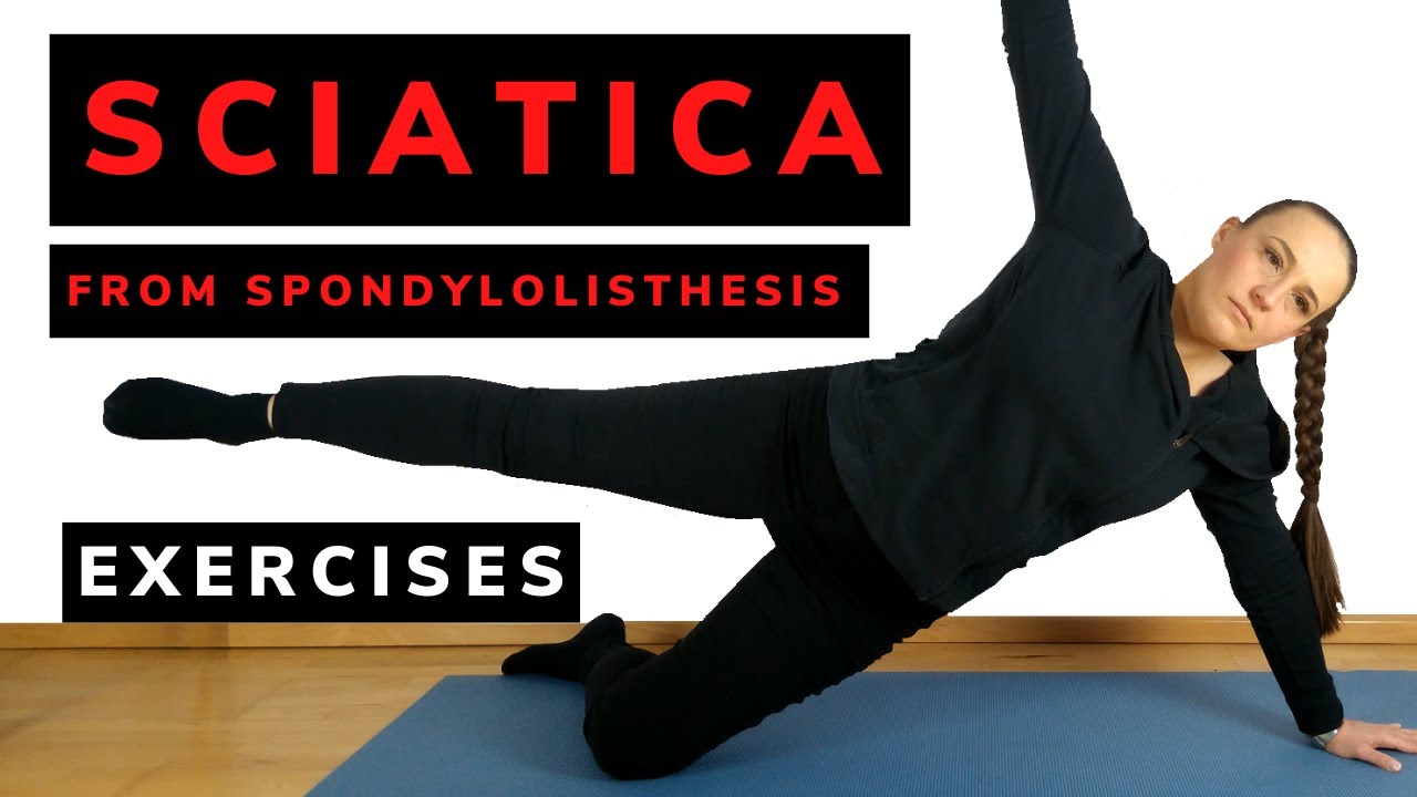 Sciatica from spondylolisthesis - what exercises to do?
