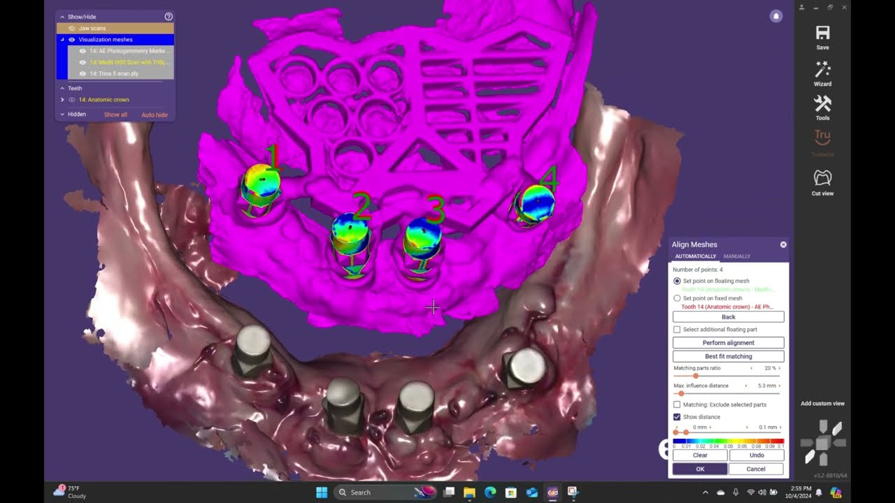 Aoralscan Elite Photogrammetry Scan vs Trios 5 Scan vs Medit i900 Grammetry Scan