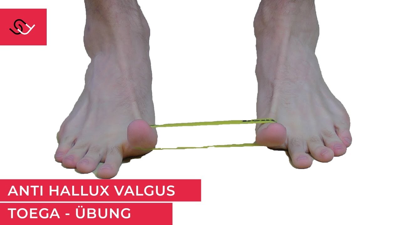 Hallux Valgus - Diese Toega Übung wird Dir helfen