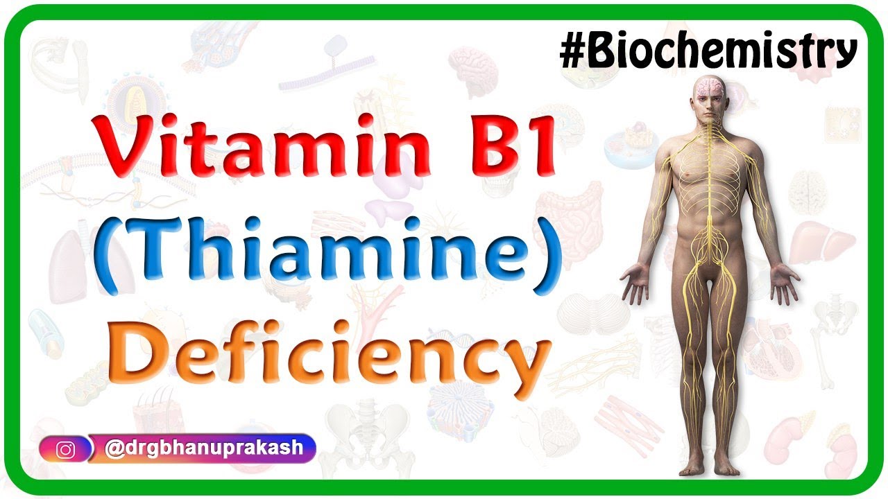 Vitamin B1 (Thiamine) Deficiency - USMLE Biochemistry Vitamins Case Based Discussion | USMLE step 1