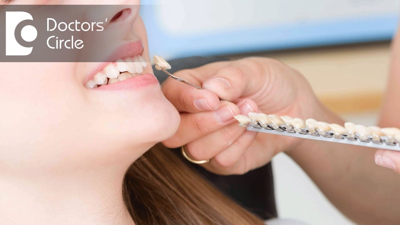Can one place Dental Implant for congenitally missing teeth? - Dr. Rajeev Kumar G