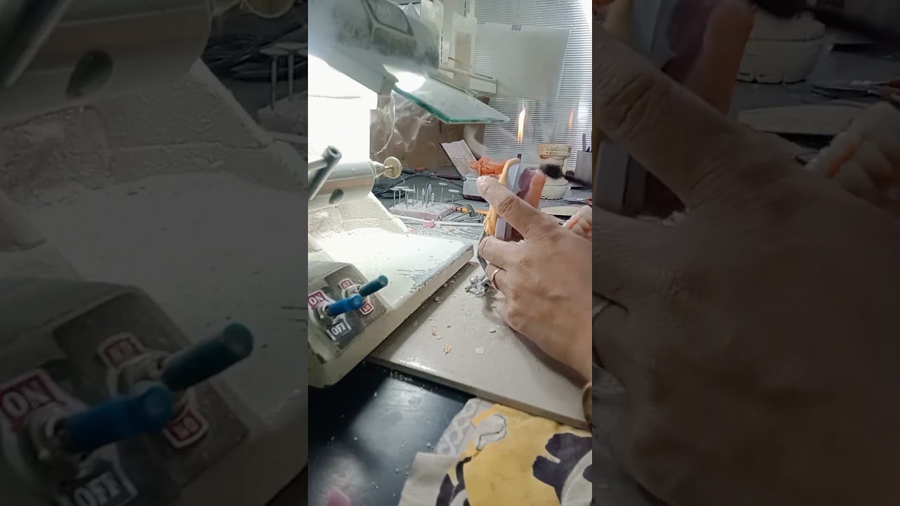 Full denture try in upper and lower ❤️#denture #dentaltechnician #dental