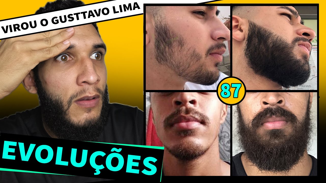 EVOLUÇÃO DOS INSCRITOS / MINOXIDIL #87