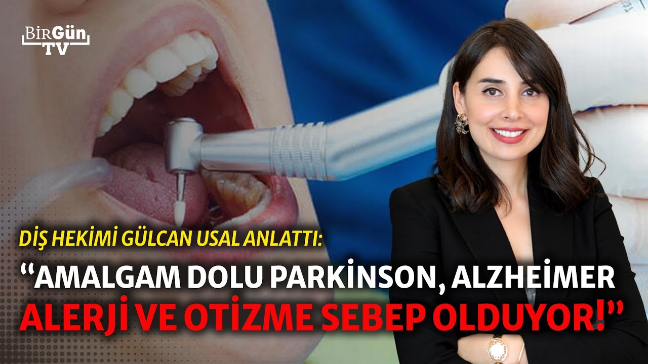 Dişinde dolgu olanlar dikkat! Hayati risk barındıran amalgam dolgu nedir? 
