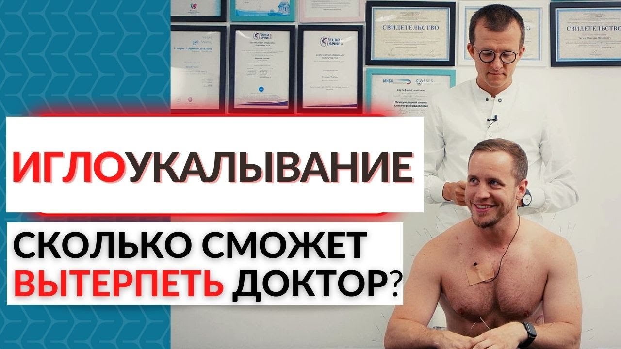 Выпуск про иглоукалывание / Ткачев, 150 ИГЛ и Епифанов.