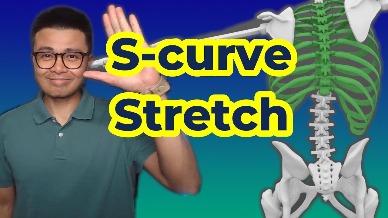 Treating S-Curve Scoliosis: The Best Stretching Exercise in 2024