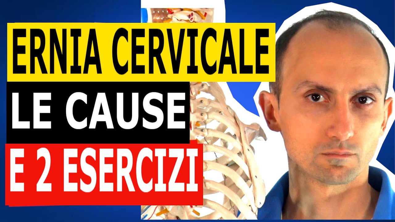 Ernia Cervicale: le Cause e 2 Esercizi Efficaci (che ho Testato)
