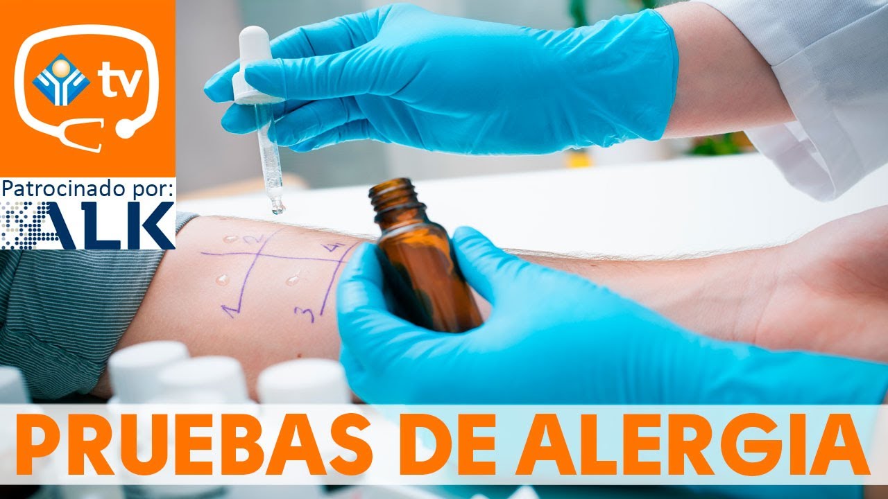 &iquest;C&oacute;mo se realizan las pruebas de alergia?