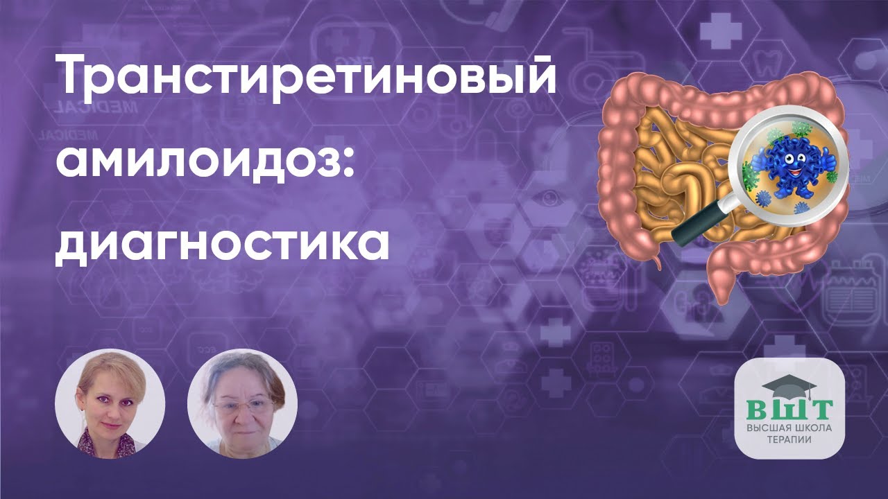 Транстиретиновый (наследственный и приобретенный) амилоидоз, симптомы и признаки.