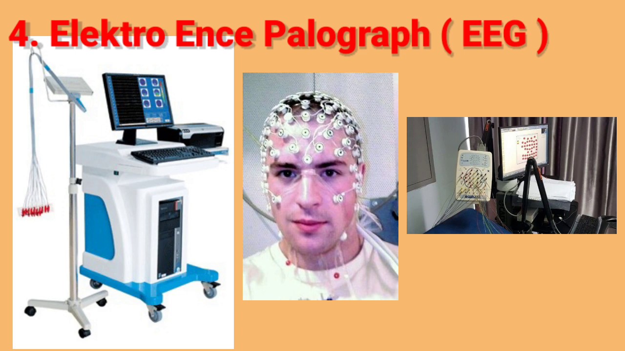 Peralatan Diagnostik || Teknik Elektromedik