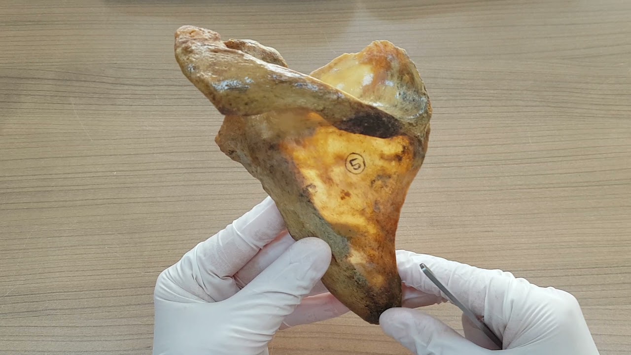 Clavicula ve Scapula Anatomisi (Köprücük ve Kürek Kemikleri)