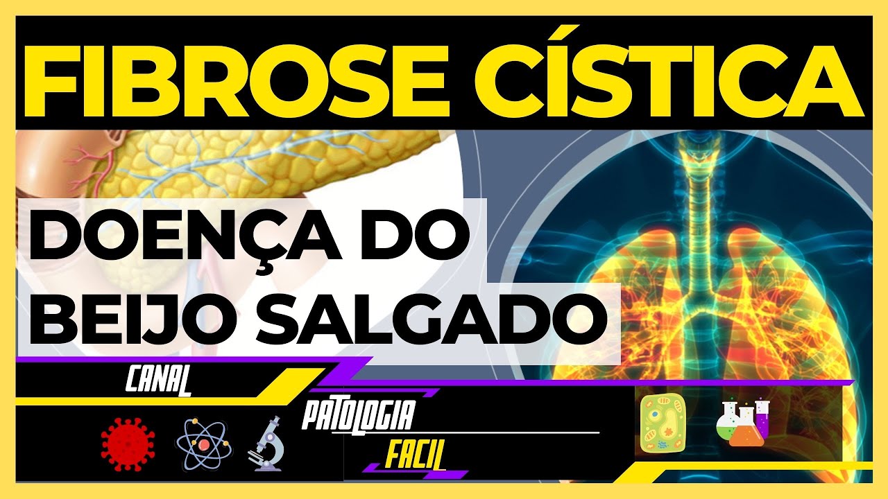 Fibrose cística: Conhecida como doença do beijo salgado