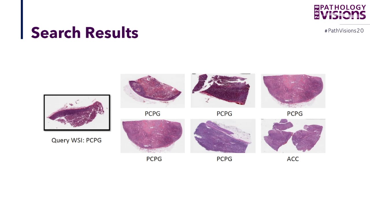 KimiaNet - Training a Histopathology Deep Network from Scratch