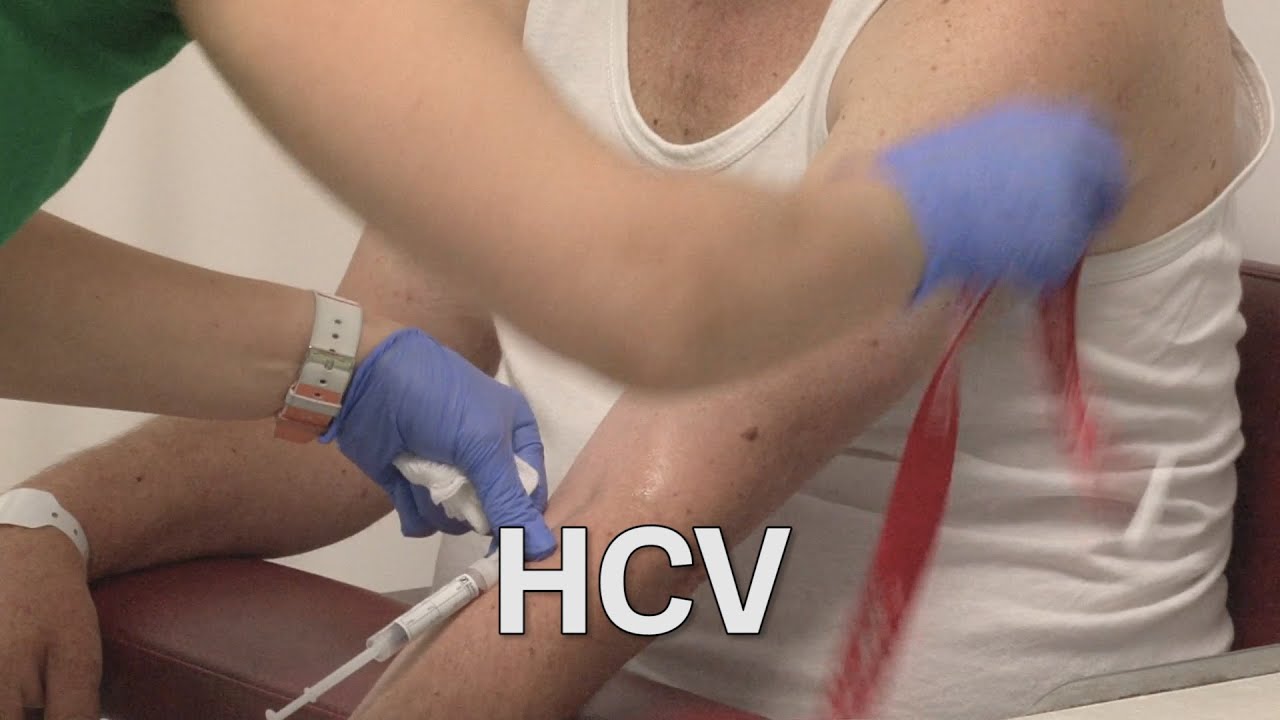 HCV