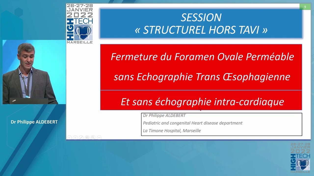 FOP sans ETO   Philippe Aldebert