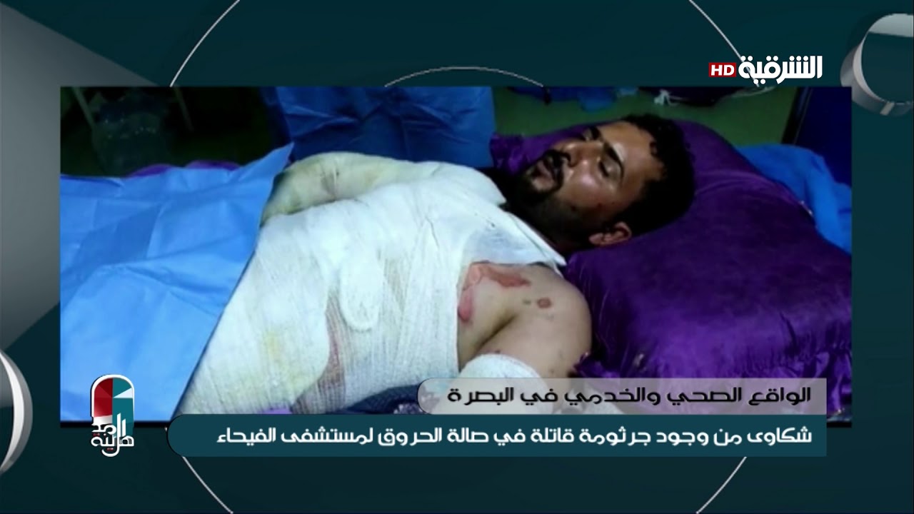 اهل المدينة 28-9-2019 | شكاوى من وجود جرثومة قاتلة في صالة الحروق لمستشفى الفيحاء بالبصرة