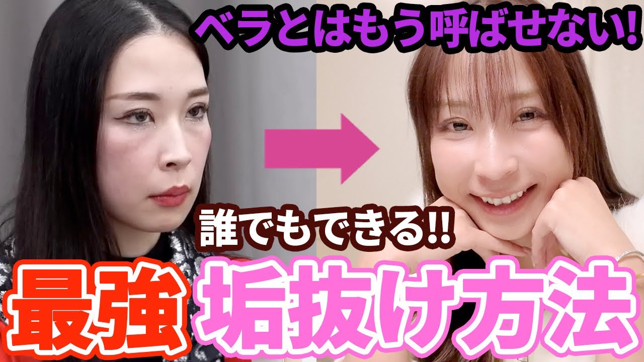 【整形じゃないよ】ベラから垢抜けた最強美容術を全部話します