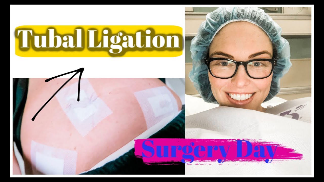 _ TUBAL LIGATION | SURGERY VLOG | POST OPERATION DAY 1 | SARAH&rsquo;S WIFESTYLE