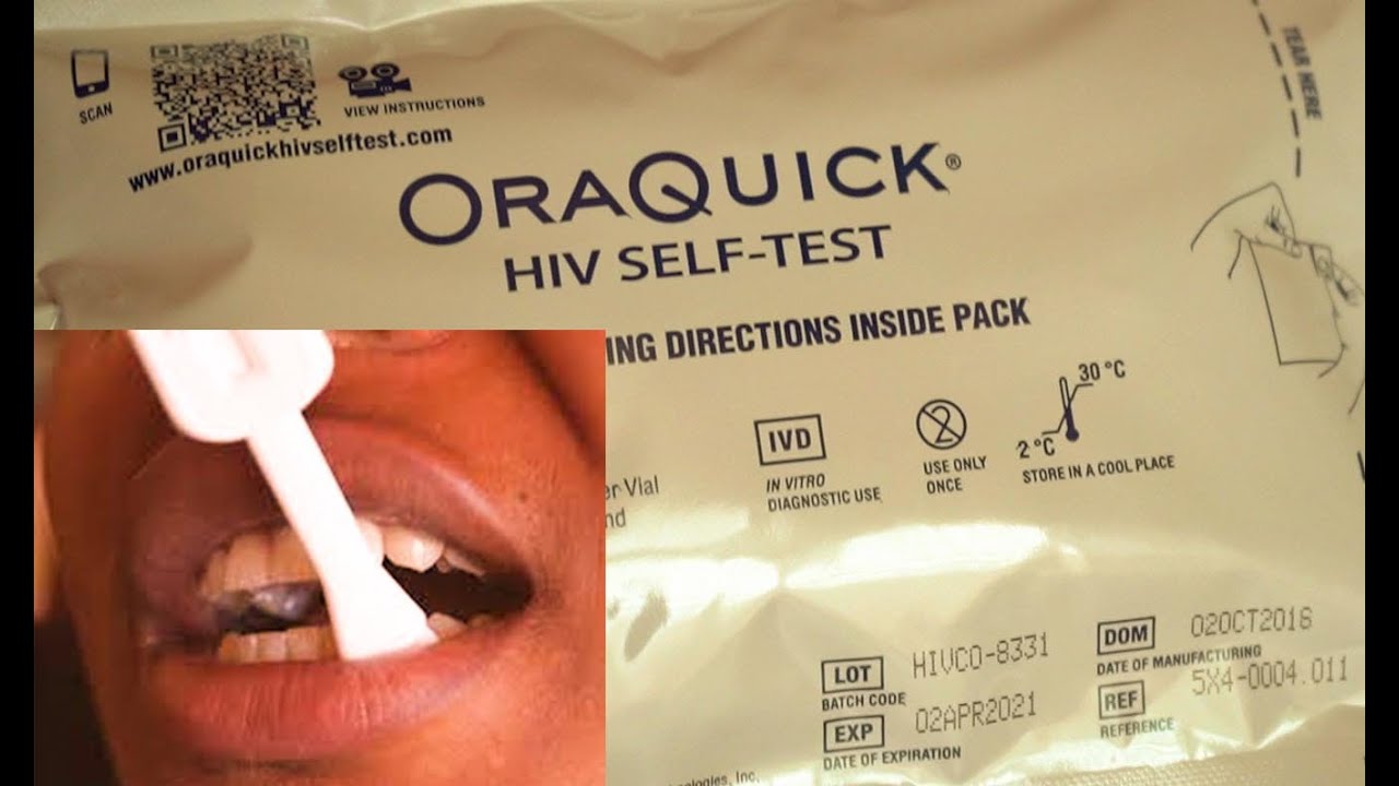 UBURYO BWO KWISUZUMA VIRUS ITERA SIDA (ORAQUICK HIV SELF-TEST)