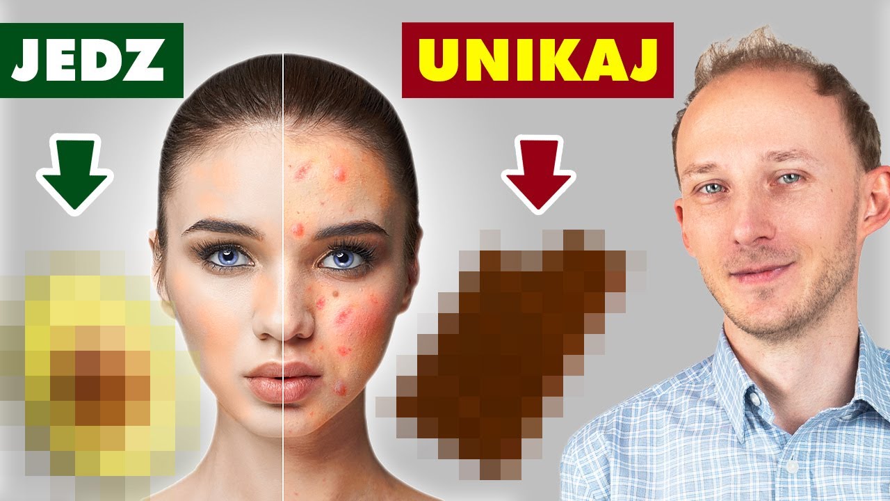 Trądzik: jak się go pozbyć dietą? Czyli co jeść na trądzik, aby go zwalczyć | Dr Bartek Kulczyński