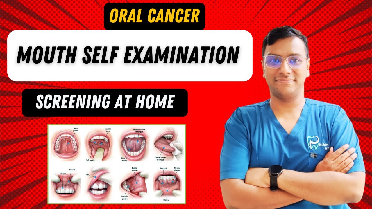Dr Rudra Mohan : A Step-by-Step Guide to Oral Cancer Screening Self-Examination at Home