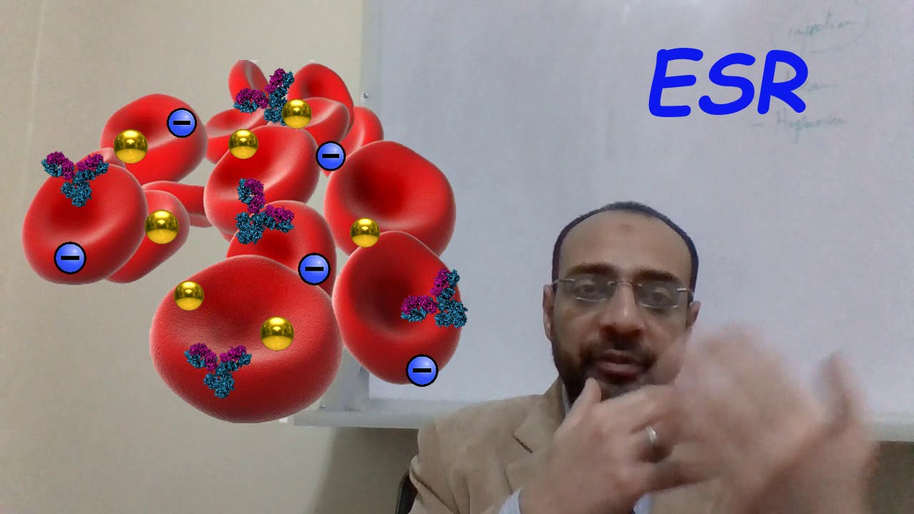 ESR, تحليل سرعة الترسيب