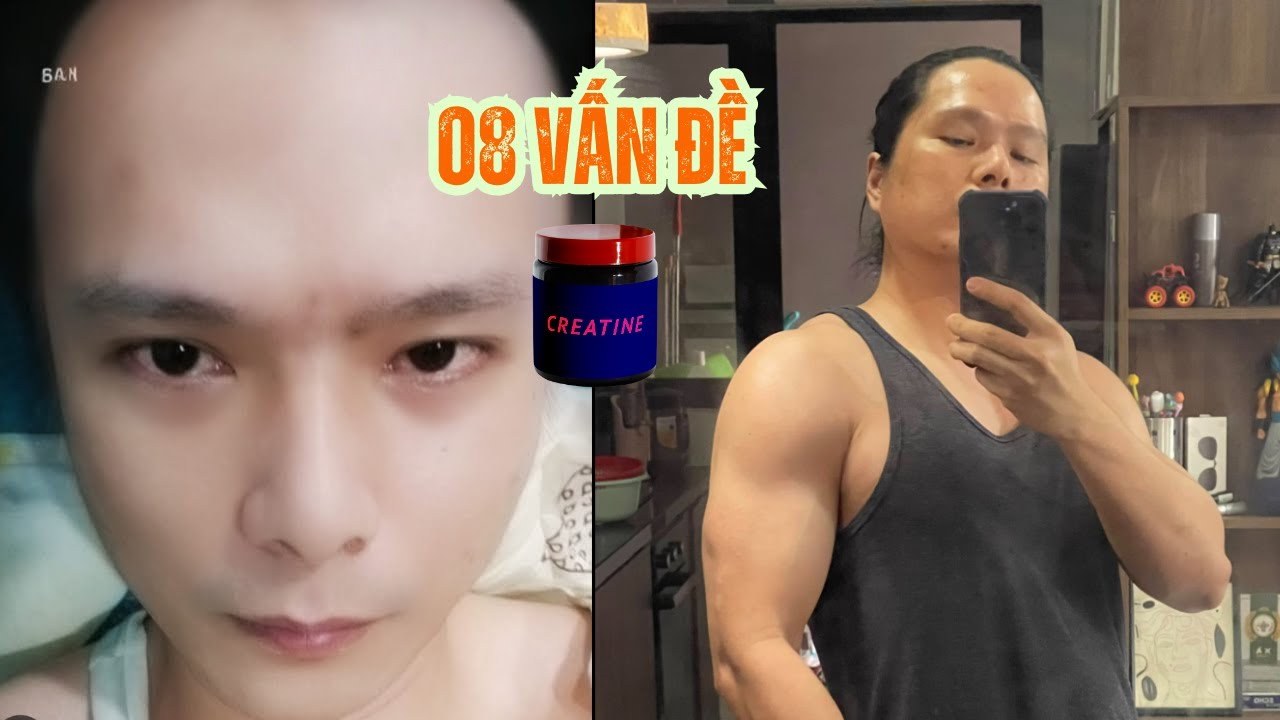 Dùng Creatine gây rụng tóc ? 08 vấn đề thường gặp về Creatine