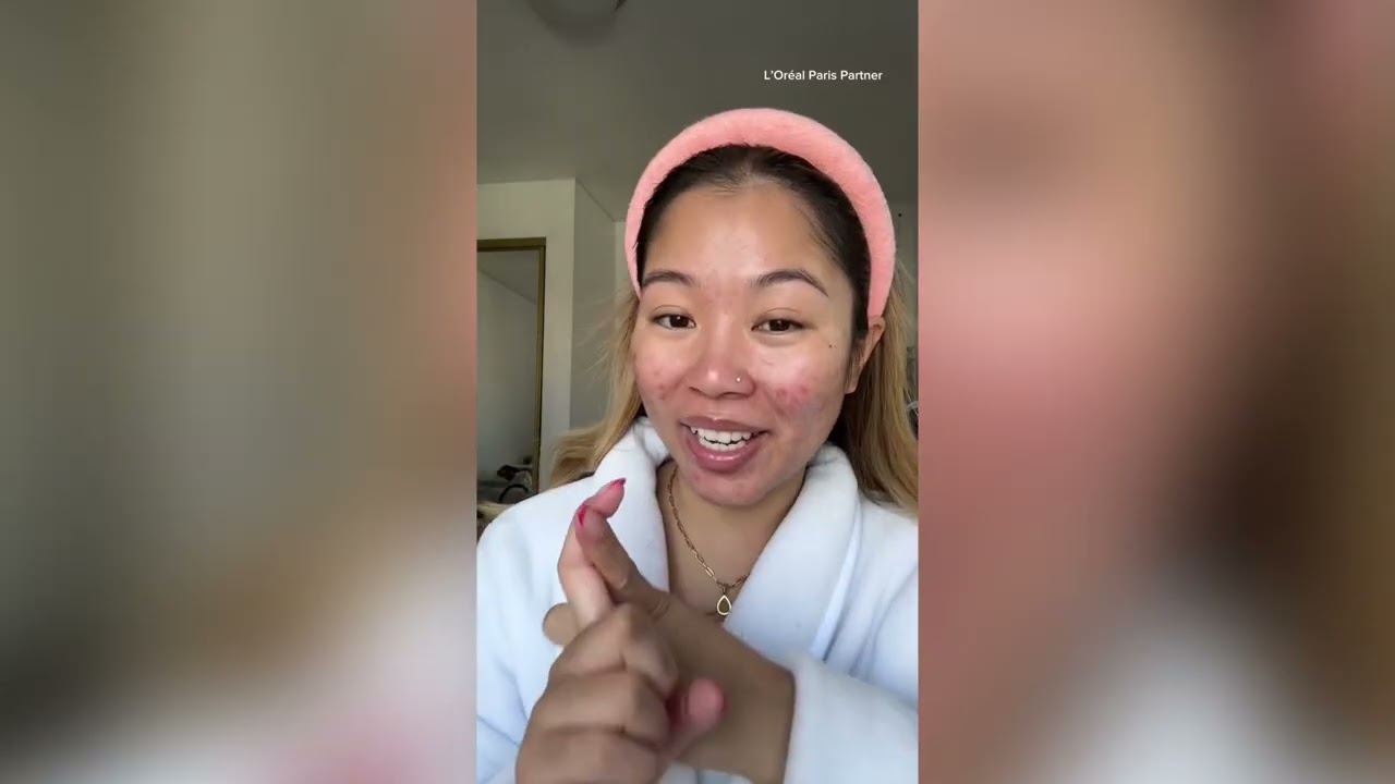 L'Oreal Paris Bright Reveal Exfoliant Peel - Real Before + After Results