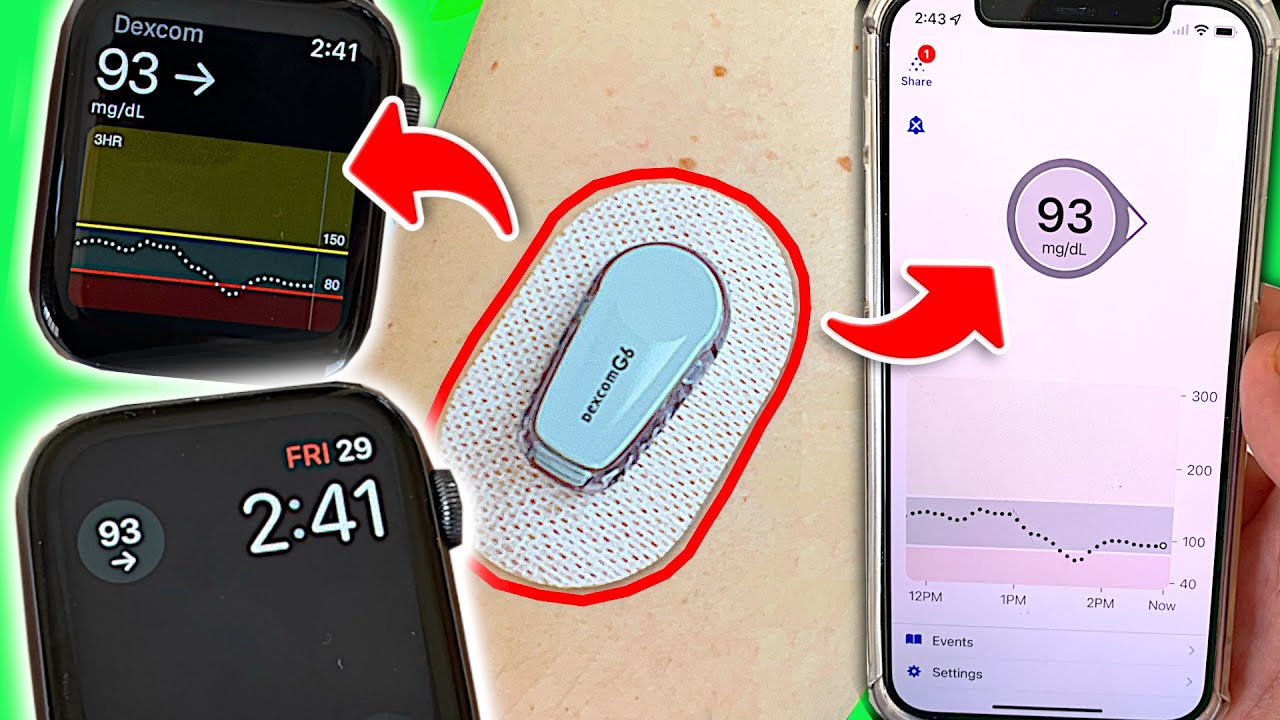 How to View Blood Sugars on Phone and Watch: 4 Tips for Dexcom Users