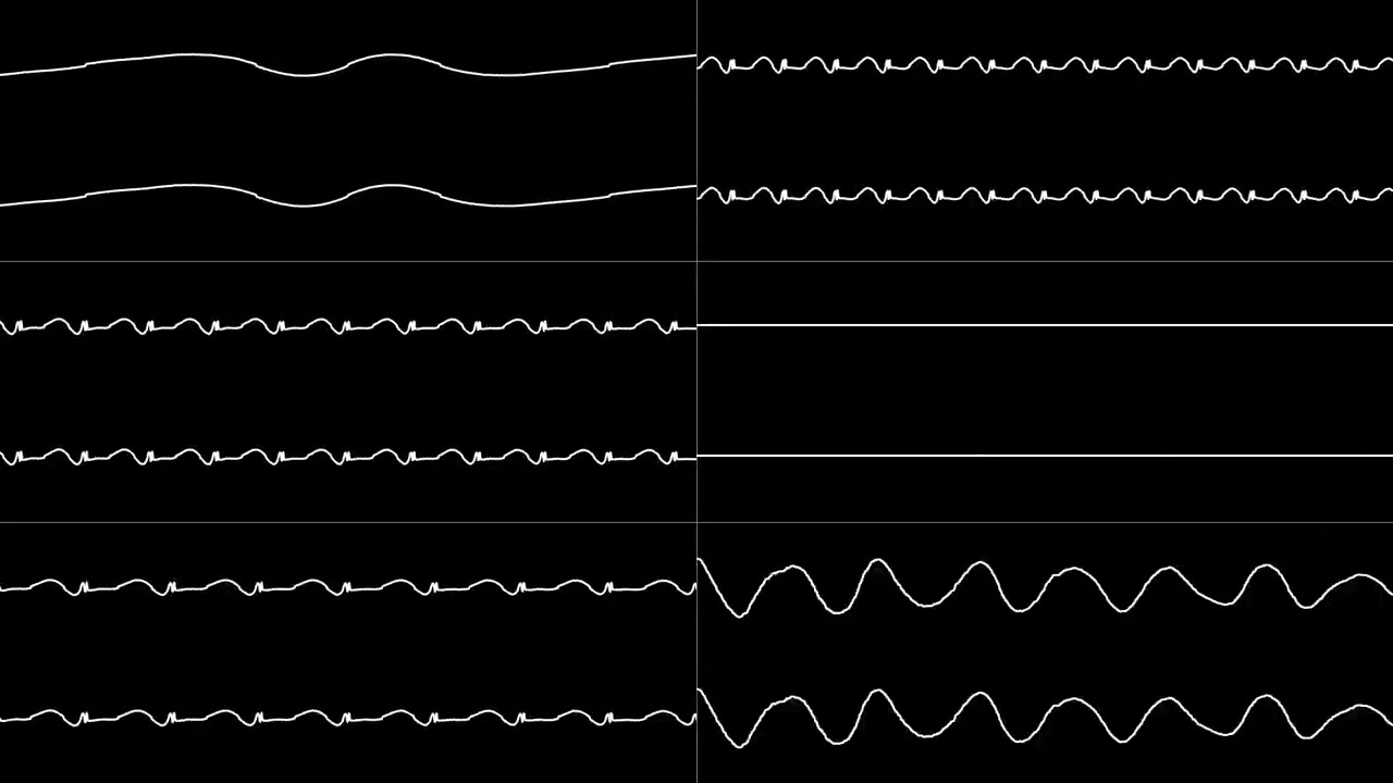Matt Furniss - &ldquo;Bubble and Squeak MD⧸Genesis&rdquo; Full Soundtrack Oscilloscope View (Reupload)