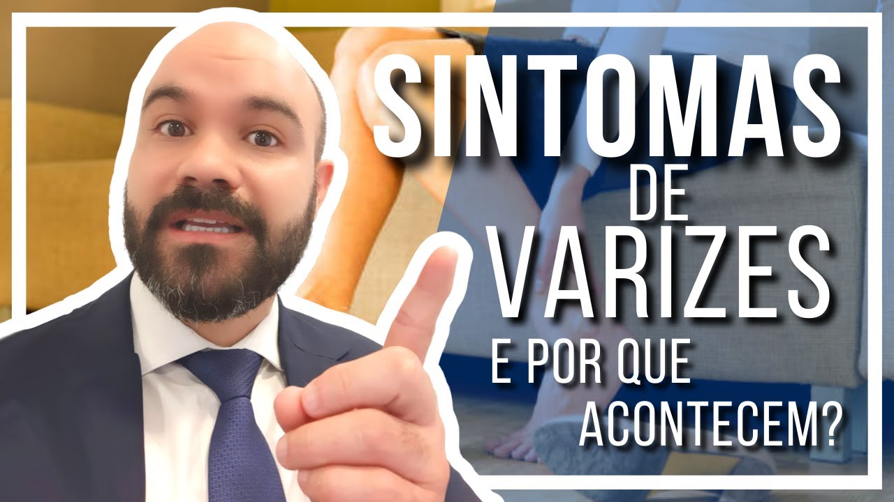 🔴 Quais s&atilde;o os SINTOMAS de Varizes [Voc&ecirc; provavelmente sente algum]