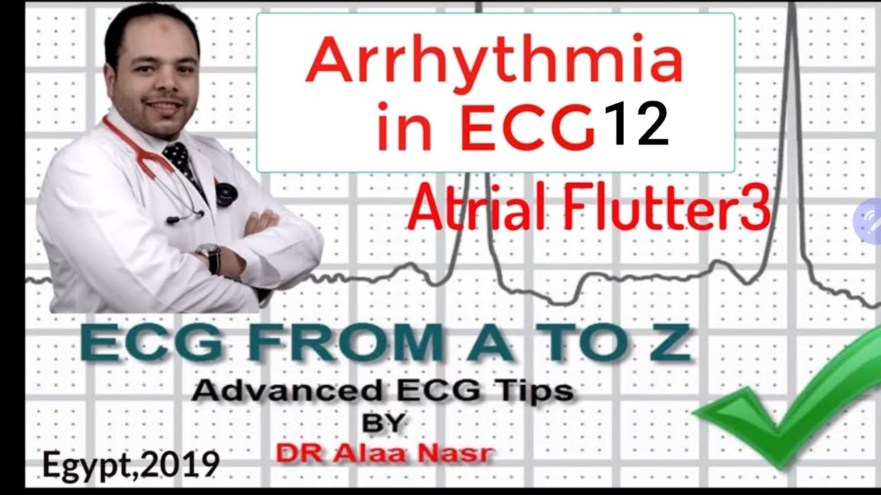 ECG from A to Z, intermediate level, Arrhythmia 12, Dr Alaa Nasr, 2019