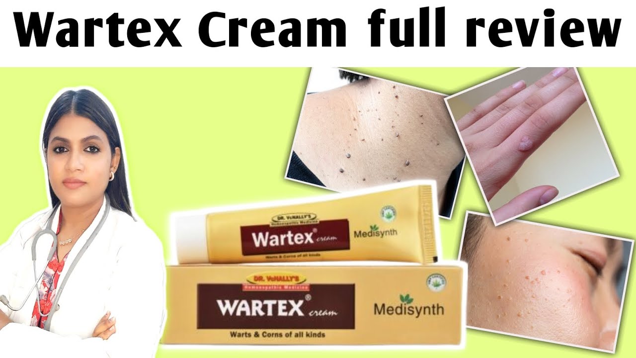 Wartex cream uses for warts removal | wartex Cream full review in hindi 