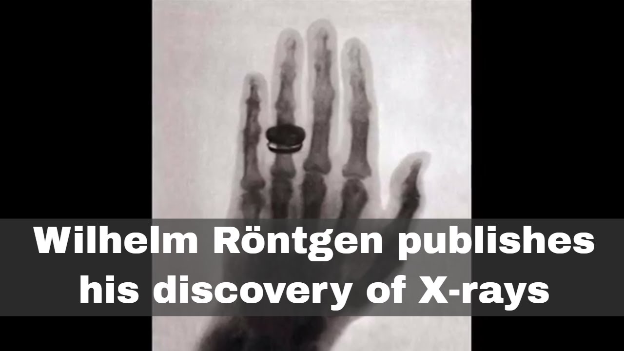 28 grudnia 1895: Wilhelm R&ouml;ntgen publikuje swoje odkrycie promieni X