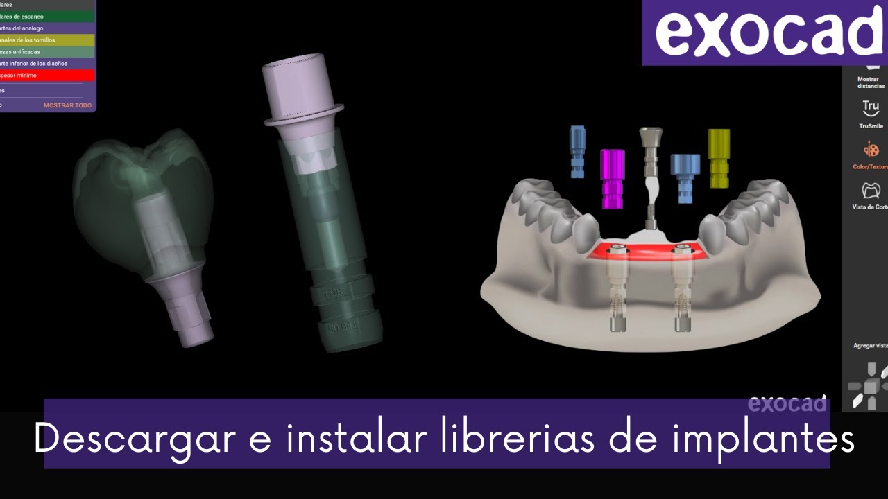 💥Como descargar e instalar libreria de implantes en exocad FÁCIL Y RÁPIDO!💥