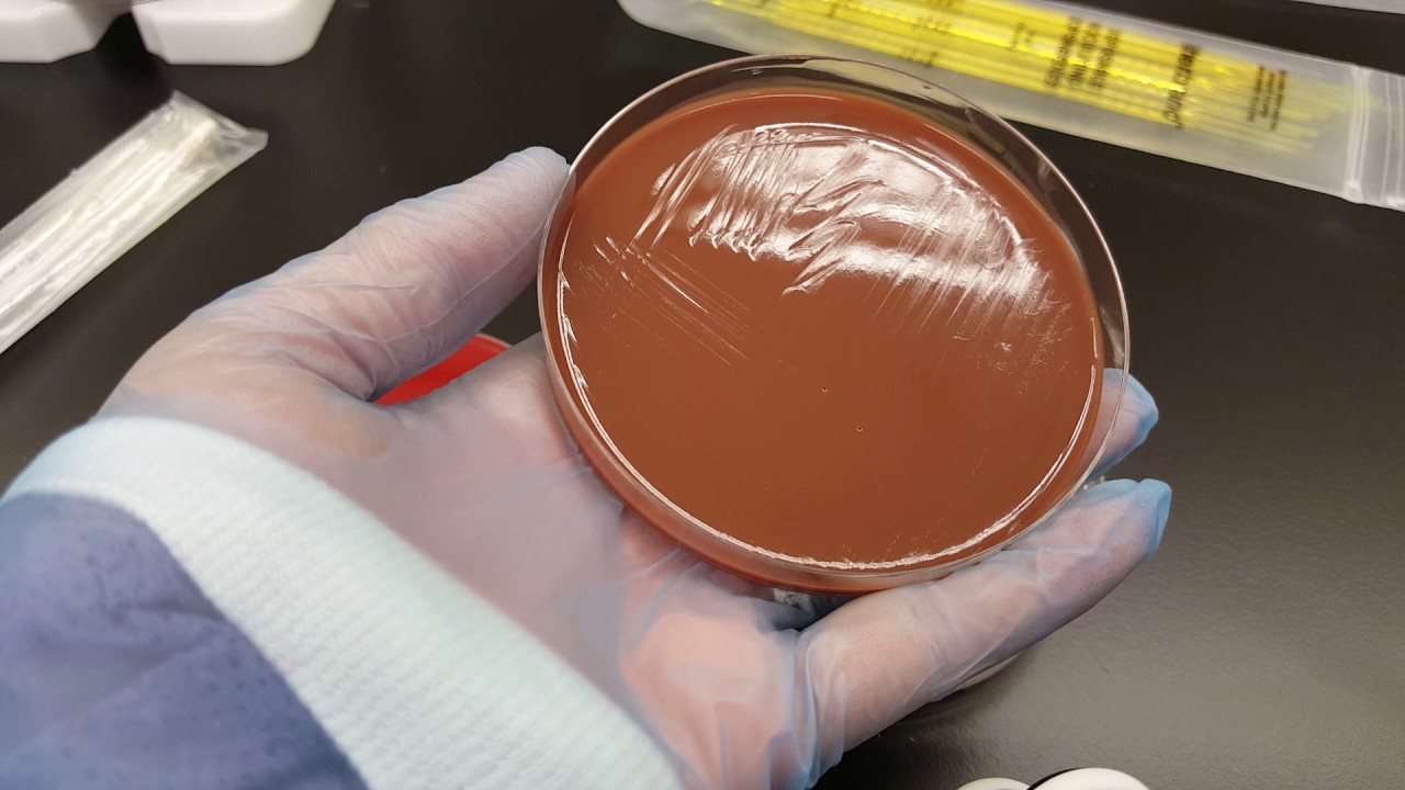 Microbiology: How to streak a Primary Set up with a Swab Specimen Part 2