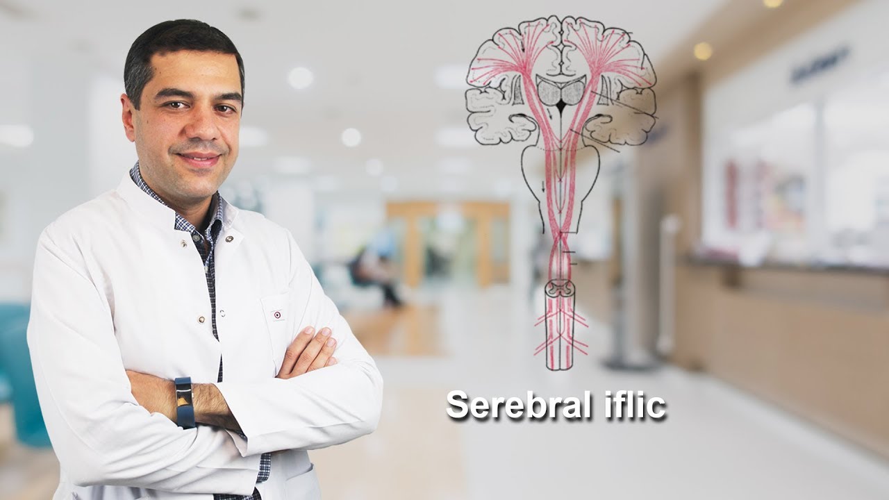 Dr. Kamran Salayev  Ixtisas: Uşaq nevroloqu  Mövzu: Serebral iflic