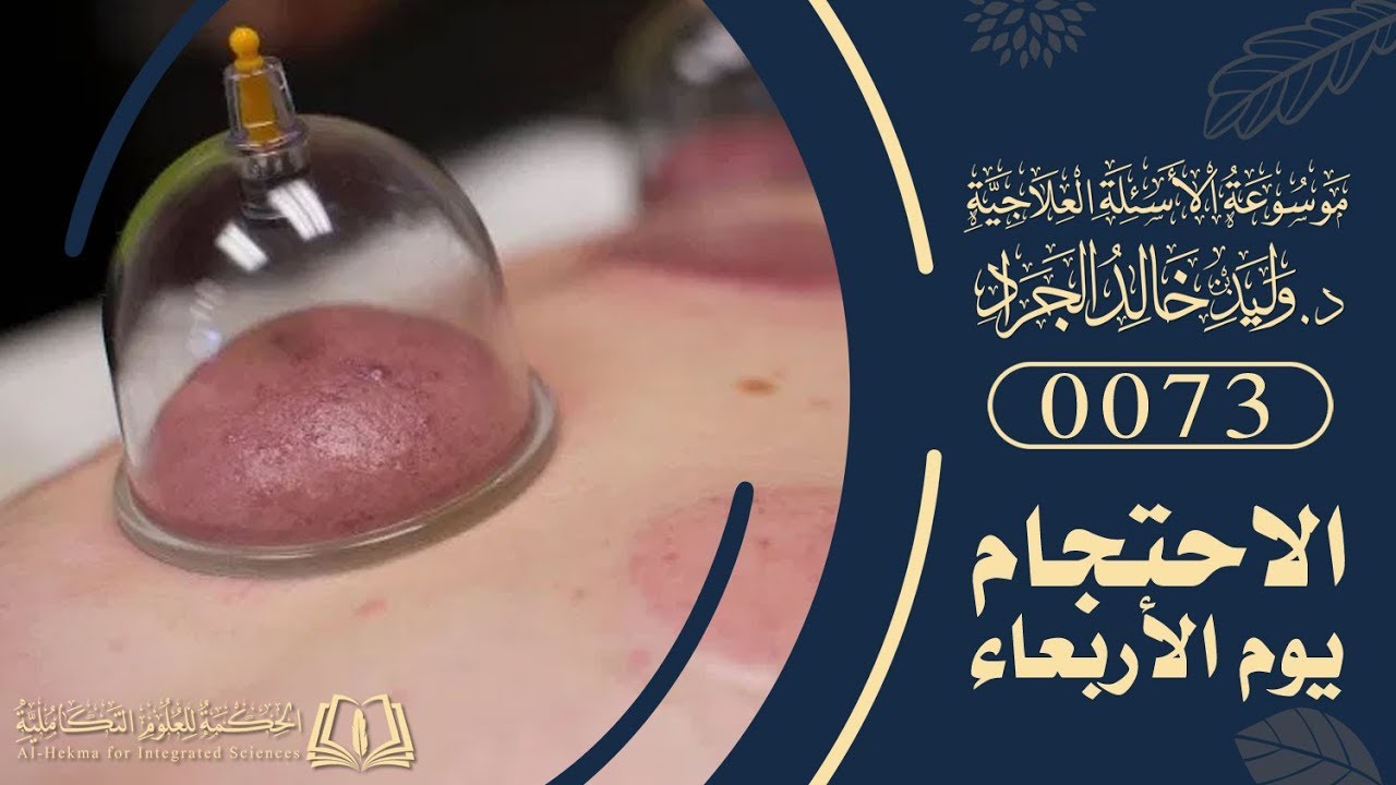 السؤال [73] [5-20]: ما هو تعليقك على الاحتجام يوم الأربعاء؟