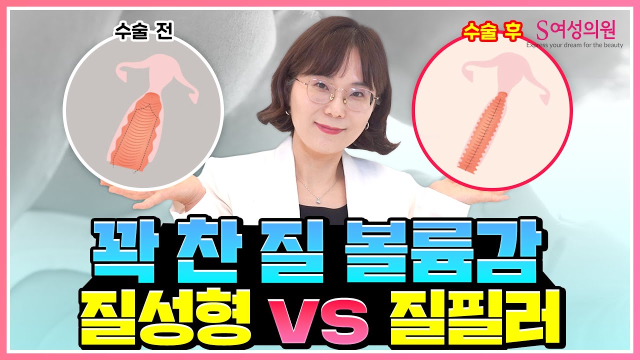 꽉 찬 질 볼륨감을 원한다면? 질 성형 vs 질필러 ( 강남 산부인과 )