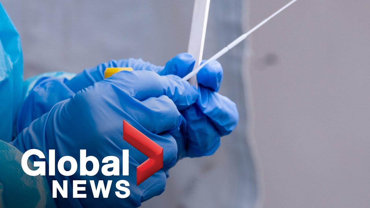 Coronavirus: Why we don't know the true death rate for COVID-19